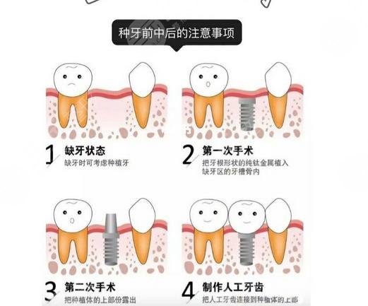 毛晓彤演技再强也救不了这位演员的挤眉弄眼(图1)