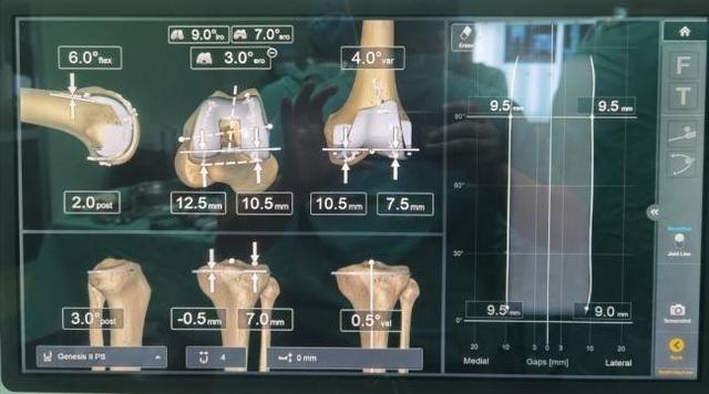 天智航涨715%成交额200亿元近5日主力净流入113204万(图1)
