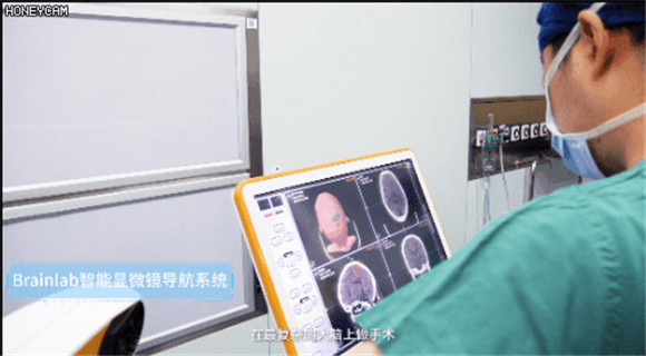 为穿刺手术配上“导航”松江这家企业的机器人厉害了!(图1)